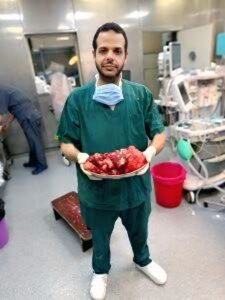 استئصال ورم يزن 9 كجم بنجاح في قصر العيني