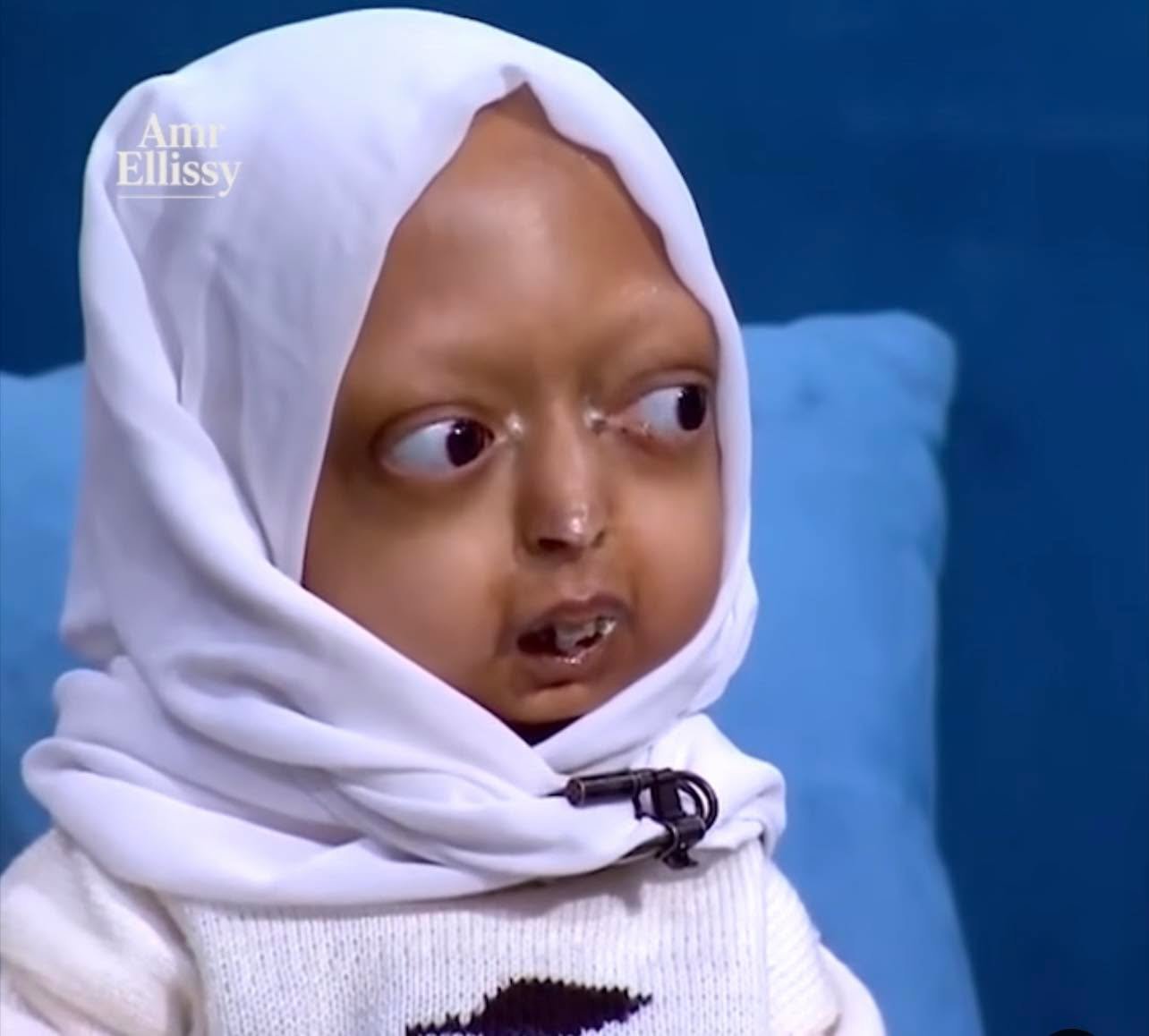 طفلة الشيخوخة المبكرة آلاء تخطف الأنظار في «واحد من الناس».. قصة مؤثرة تهز مشاعر الملايين 9 طفلة الشيخوخة المبكرة آلاء تخطف الأنظار في «واحد من الناس».. قصة مؤثرة تهز مشاعر الملايين